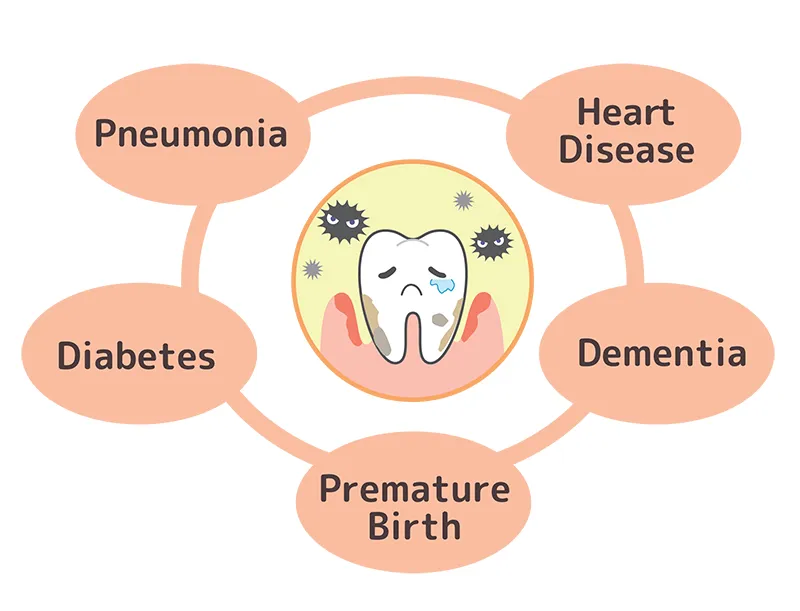 Periodontal disease and diabetes